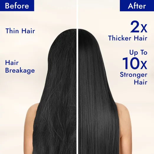 Parachute Advansed Castor & Shea-Enriched Coconut Hair Oil — 200 ml